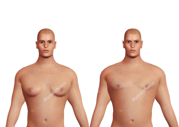 depositphotos-bgremover_349847930-stock-photo-gynecomastia-cosmetic-correction-surgery-man-removebg-preview